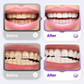 Lysozyme Brightening Stain-Removing Toothpaste